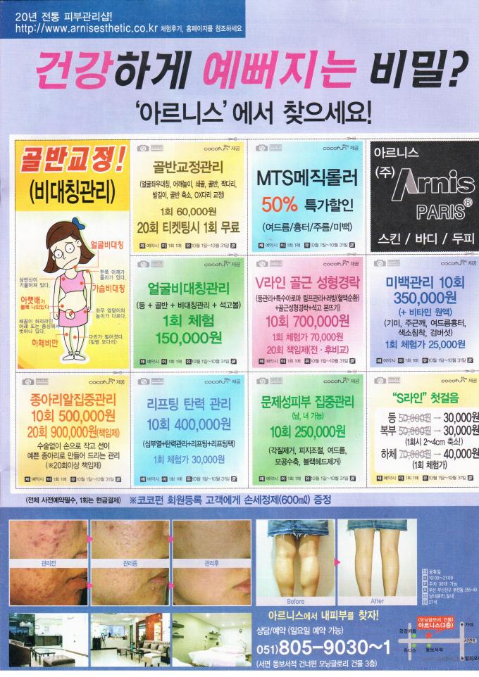 Korean Calf Reduction Surgery Advertisement